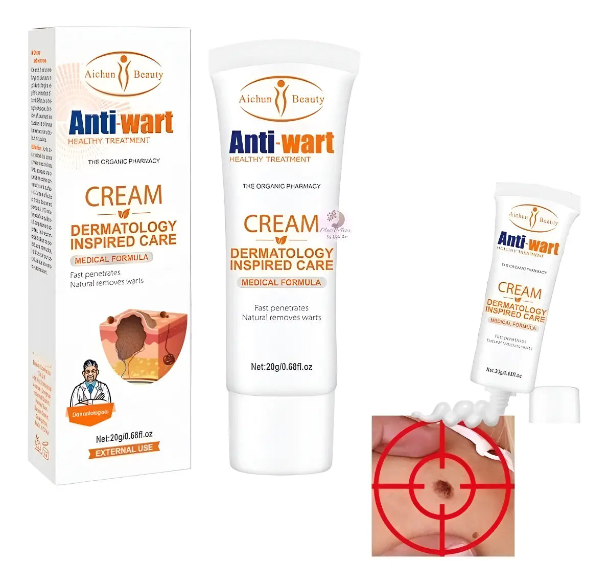 Crema Dermatológica Avanzada para el Tratamiento y Eliminación de Verrugas